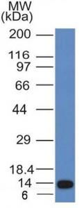 Western blot analysis of recombinant fragment of ALK using Anti-ALK Antibody [ALK/1031]