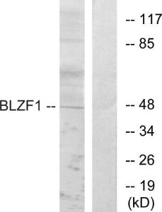 Western blot analysis of lysates from Jurkat cells using Anti-BLZF1 Antibody. The right hand lane represents a negative control, where the antibody is blocked by the immunising peptide