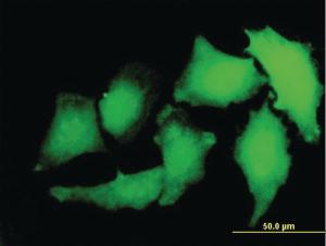 Anti-S100 A2 Mouse Monoclonal Antibody [clone: M2]