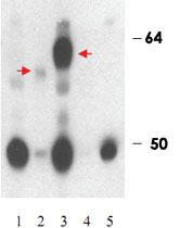 Anti-THRB Rabbit Polyclonal Antibody