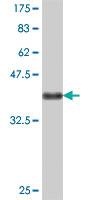 Anti-CRELD2 Mouse Polyclonal Antibody