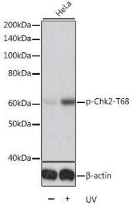 Western blot analysis of extracts of HeLa cells, using Anti-Chk2 (phospho Thr68) Antibody (A11068). HeLa cells were treated by UV for 15-30 minutes. The secondary antibody was Goat Anti-Rabbit IgG HandL Antibody (HRP) at 1:10,000 dilution