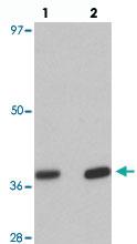 Anti-EI24 Rabbit Polyclonal Antibody