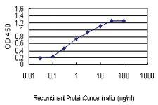 Anti-S100 A2 Mouse Monoclonal Antibody [clone: M2]