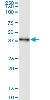 Anti-AIM2 Polyclonal Antibody Pair