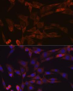 Immunofluorescence analysis of NIH-3T3 cells using Anti-Inhibin beta A Antibody [ARC1177] (A307621) at a dilution of 1:100 (40X lens). DAPI was used to stain the cell nuclei (blue)