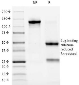 SDS-PAGE analysis of Anti-ALK Antibody [ALK/1032] under non-reduced and reduced conditions; showing intact IgG and intact heavy and light chains, respectively. SDS-PAGE analysis confirms the integrity and purity of the antibody.