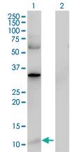 Anti-S100 A4 Mouse Polyclonal Antibody