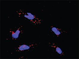 Anti-MAPK3 + ARRB2 Antibody Pair