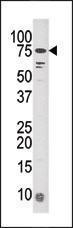 Anti-BRSK1 Rabbit Polyclonal Antibody (FITC (Fluorescein))