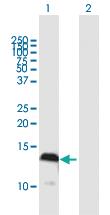 Anti-S100 A4 Mouse Polyclonal Antibody