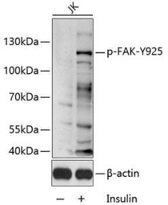 Western blot analysis of extracts of Jurkat cell line, using Anti-FAK (phospho Tyr925) Antibody (A11075) 1:1000 dilution. The secondary Antibody was Goat Anti-Rabbit IgG H&L Antibody (HRP) at 1:10000 dilution