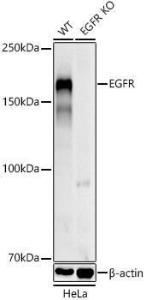 Western blot analysis of extracts from wild type(WT) and EGFR knockout (KO) HeLa cells, using Anti-EGFR Antibody (A308694) at 1:1,000 dilution