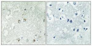 Immunohistochemical analysis of paraffin-embedded human brain using Anti-BLZF1 Antibody 1:100 (4°C overnight). The right hand panel represents a negative control, where the antibody was pre-incubated with the immunising peptide