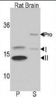 Anti-LC3 (APG8B)-24 citations Rabbit Polyclonal Antibody