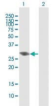 Anti-SNAI1 Mouse Polyclonal Antibody