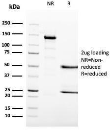 SDS-PAGE analysis of Anti-MCM6 Antibody [MCM6/3000] under non-reduced and reduced conditions; showing intact IgG and intact heavy and light chains, respectively. SDS-PAGE analysis confirms the integrity and purity of the Antibody