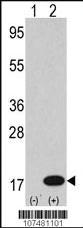 Anti-LC3 (APG8B)-24 citations Rabbit Polyclonal Antibody