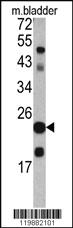 Anti-TAGLN Rabbit Polyclonal Antibody