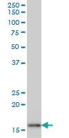 Anti-AGR2 Mouse Monoclonal Antibody [clone: 1C3]