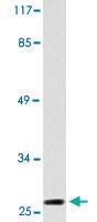 Anti-CDKN1B Rabbit Polyclonal Antibody