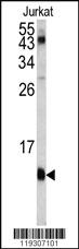 Anti-FKBP1A Rabbit Polyclonal Antibody