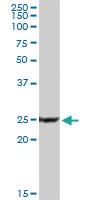 Anti-PPP3R1 Rabbit Polyclonal Antibody