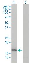 Anti-AGR2 Mouse Monoclonal Antibody [clone: 1C3]