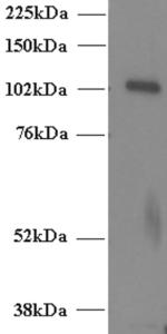 EB06383 (2 µg/ml) staining of Human T-lymphocyte lysate (35 µg protein in RIPA buffer). Primary incubation was 1 hour. Detected by chemiluminescence. Data provided by anonymous customer.