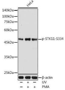 Antibody anti-STK11 phospho S334 100 µl