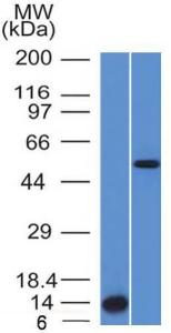 Western blot analysis of (A) recombinant ALK protein and (B) HepG2 cell lysate using Anti-ALK Antibody [ALK/1503]