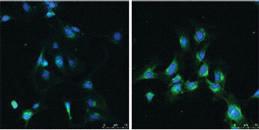 Anti-LC3 (APG8B)-24 citations Rabbit Polyclonal Antibody