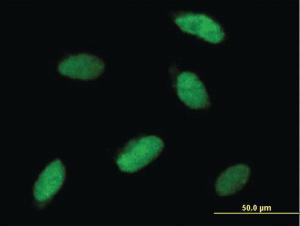 Anti-SNAI1 Mouse Polyclonal Antibody