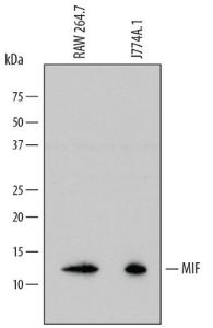 Anti-MIF Rat Monoclonal Antibody [clone: 811429]