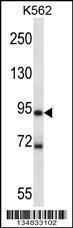 Anti-MARK1 Rabbit Polyclonal Antibody (AP (Alkaline Phosphatase))