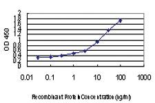 Anti-AGR2 Mouse Monoclonal Antibody [clone: 1C3]