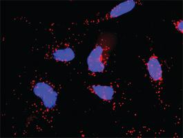 Anti-CALR + B2M Antibody Pair