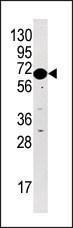 Anti-BRSK2 Rabbit Polyclonal Antibody (AP (Alkaline Phosphatase))