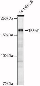 Western blot analysis of SK-MEL-28, using Anti-TRPM1 Antibody (A308697) at 1:800 dilution. The secondary antibody was Goat Anti-Rabbit IgG H&L Antibody (HRP) at 1:10,000 dilution.