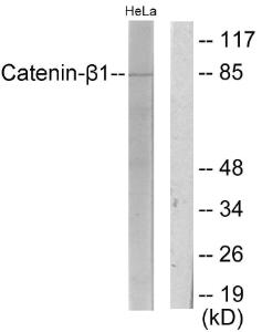 Western blot analysis of lysates from HeLa cells using Anti-Catenin-beta1 Antibody. The right hand lane represents a negative control, where the antibody is blocked by the immunising peptide