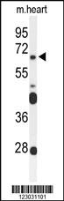 Anti-FZD4 Rabbit Polyclonal Antibody