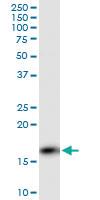 Anti-PPP3R1 Mouse Monoclonal Antibody [clone: 4E1]