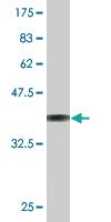 Anti-RPS3 Mouse Monoclonal Antibody [clone: 2A8]