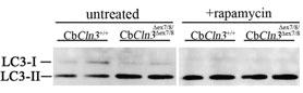 Anti-LC3 (APG8B)-24 citations Rabbit Polyclonal Antibody