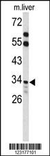 Anti-ACOT8 Rabbit Polyclonal Antibody