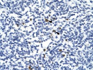 Anti-TAL1 Rabbit Polyclonal Antibody