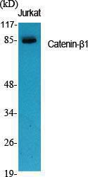 Western blot analysis of various cells using Anti-Catenin-beta1 Antibody