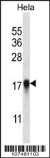 Anti-LC3 (APG8B)-24 citations Rabbit Polyclonal Antibody