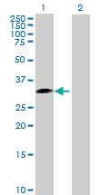 Anti-SNAI1 Mouse Polyclonal Antibody