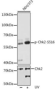 Western blot analysis of extracts of NIH/3T3 cells, using Anti-Chk2 (phospho Ser516) Antibody (A11080) at 1:1000 dilution or Chk2 antibody (A0466)